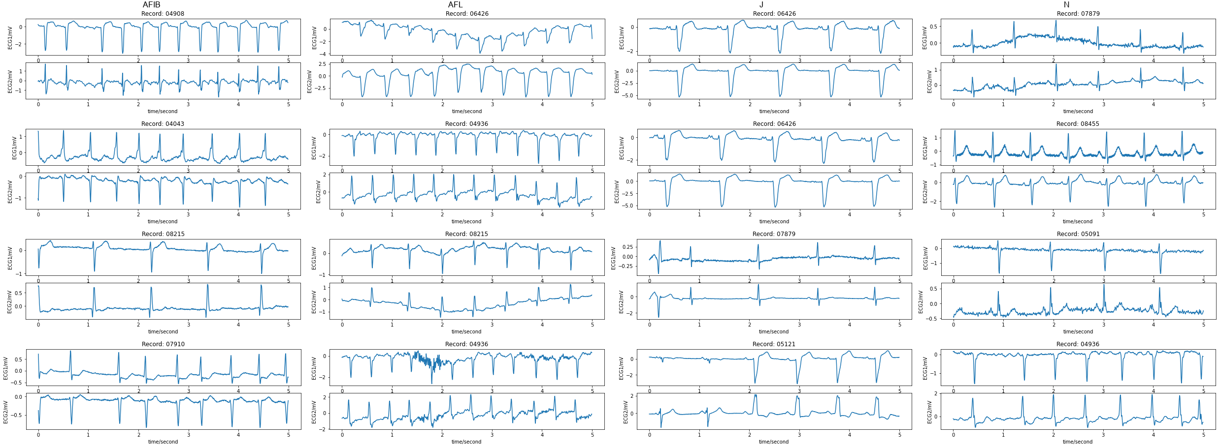 afib-detection